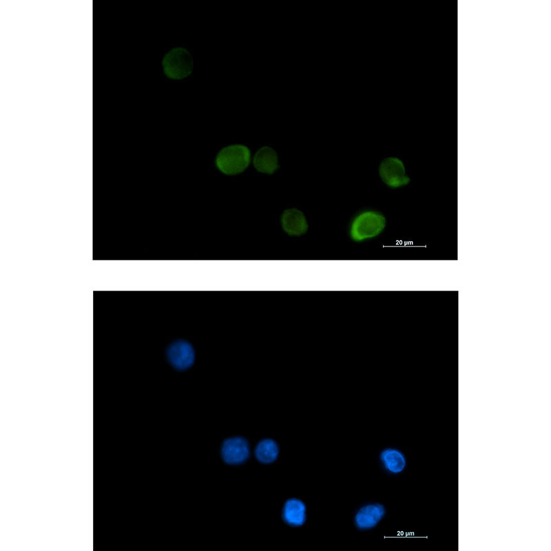 1 - [KD]MTHFR Rabbit mAb AP75749