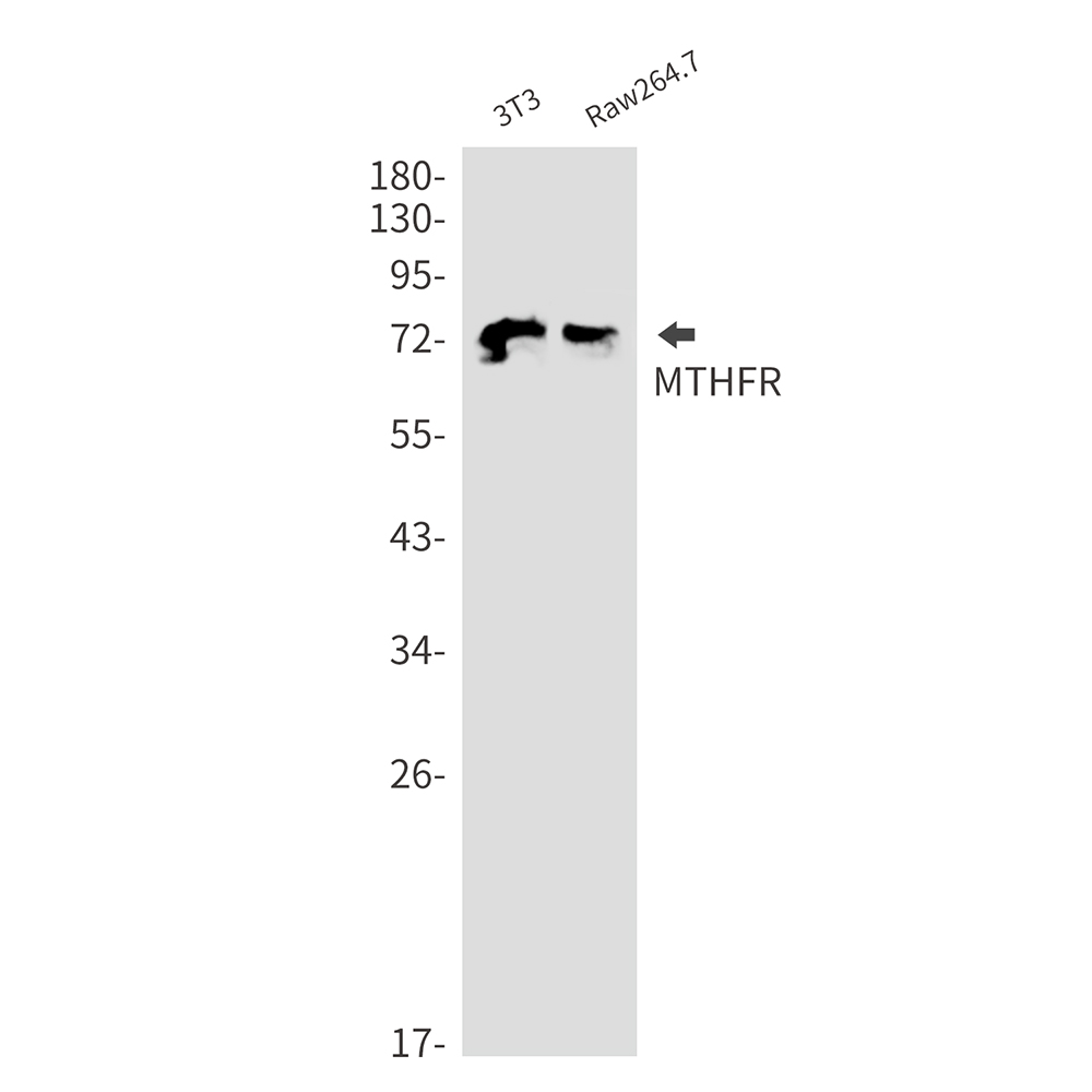 3 - [KD]MTHFR Rabbit mAb AP75749