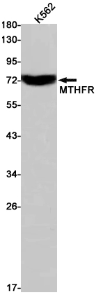 5 - [KD]MTHFR Rabbit mAb AP75749