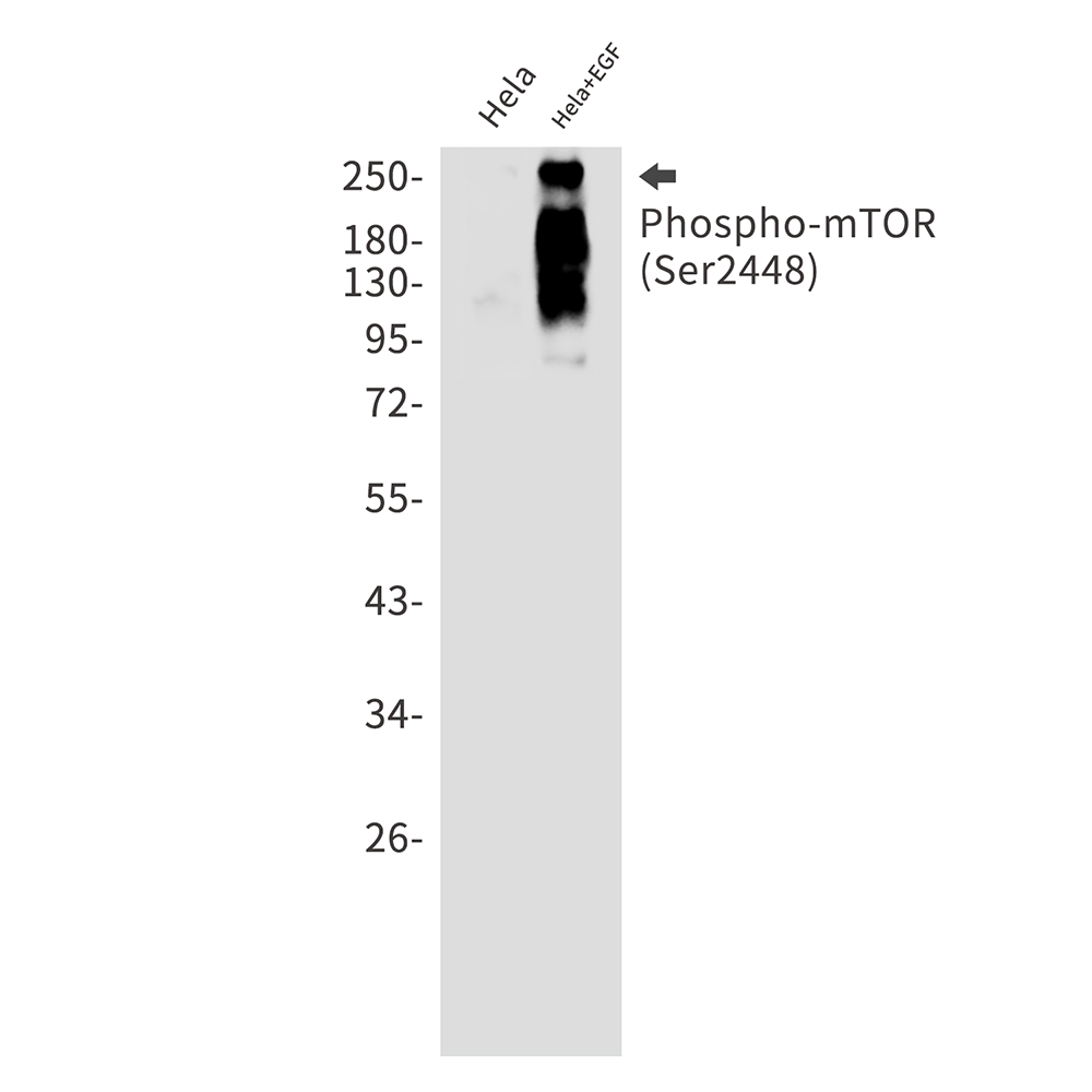 1 - Phospho-mTOR (Ser2448) Rabbit mAb AP75751