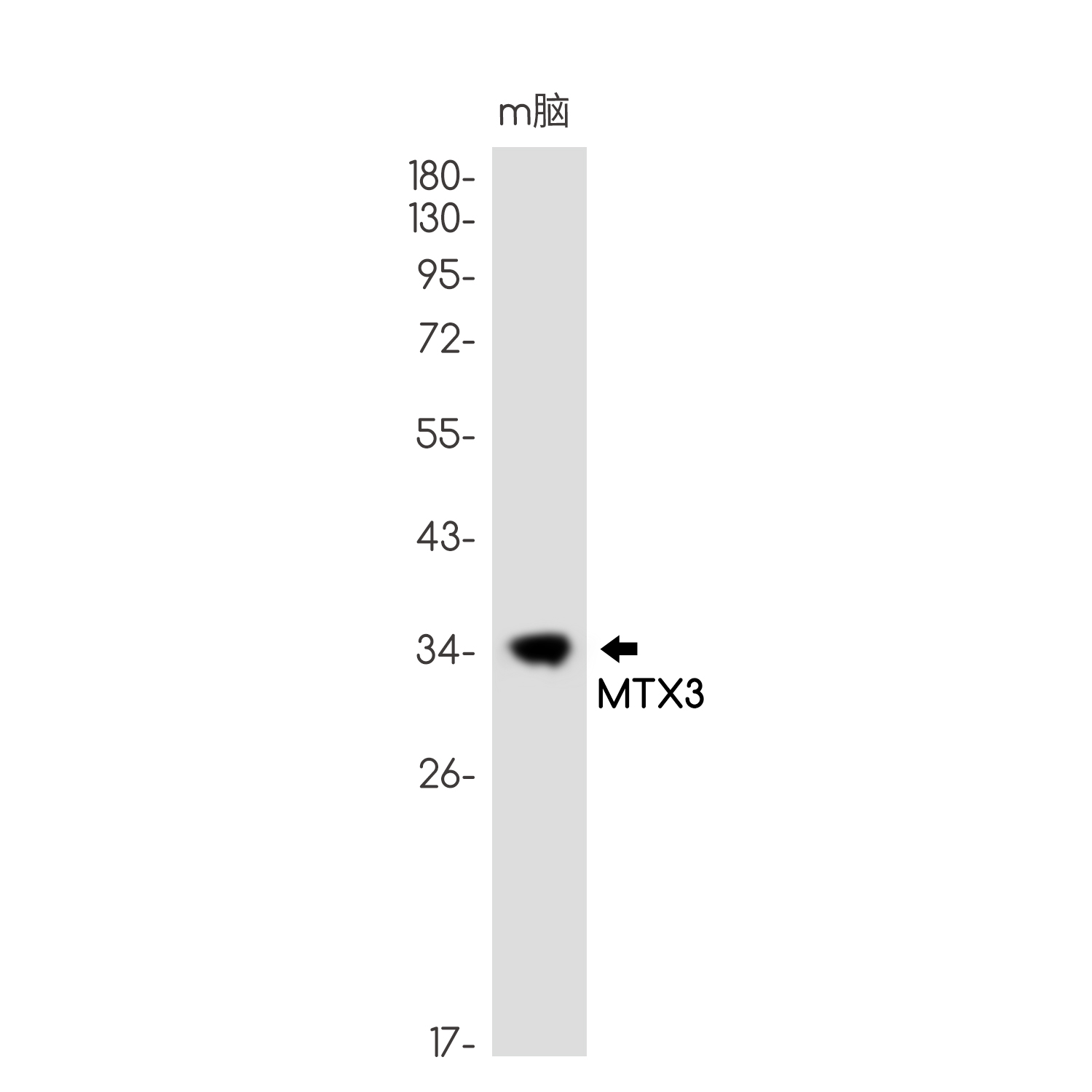 0 - MTX3 Rabbit mAb AP75752