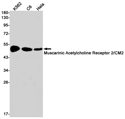 1 - Muscarinic Acetylcholine Receptor M2 Rabbit mAb AP75755