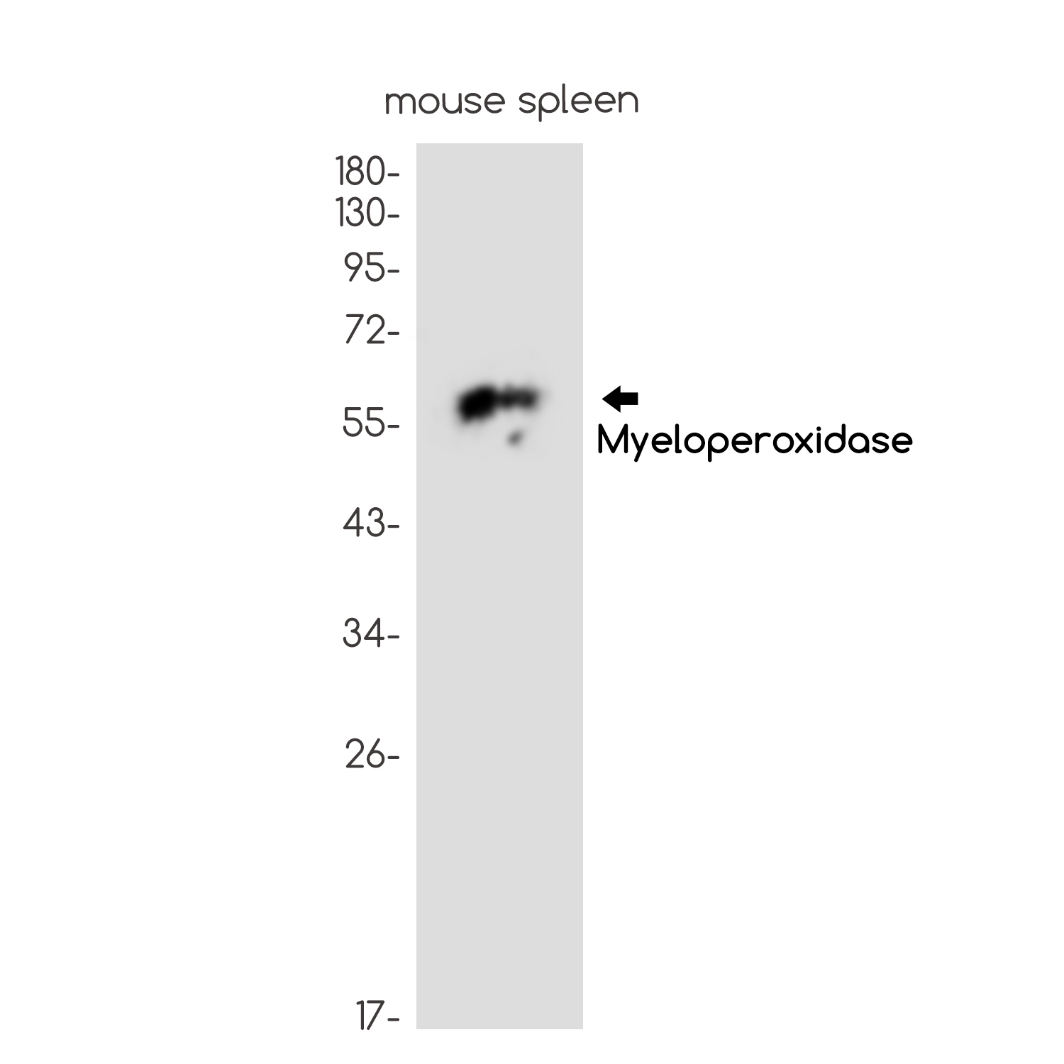 2 - Myeloperoxidase Rabbit mAb AP75765