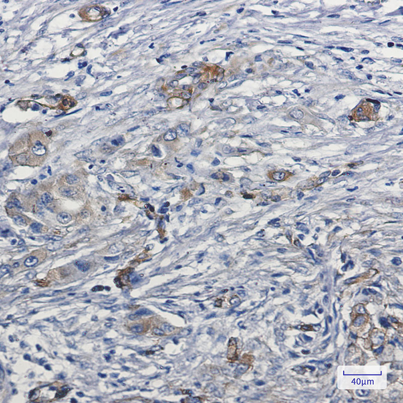2 - MYO1B Rabbit mAb AP75767
