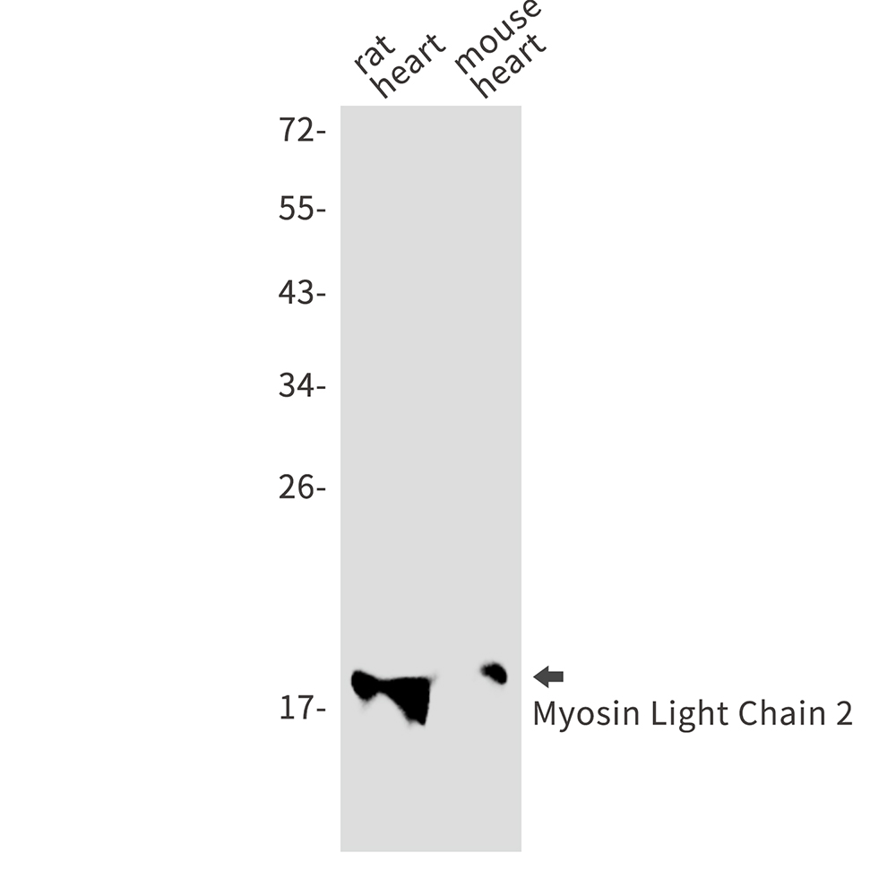 1 - Myosin Light Chain 2 Rabbit mAb AP75768