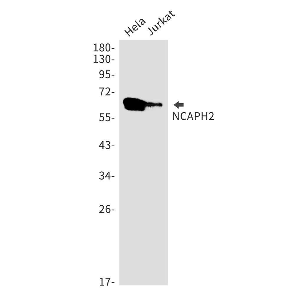 1 - NCAPH2 Rabbit mAb AP75771