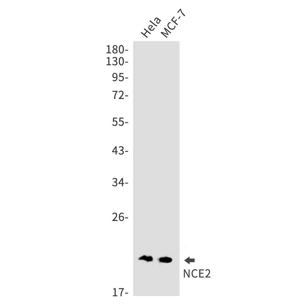 1 - NCE2 Rabbit mAb AP75772