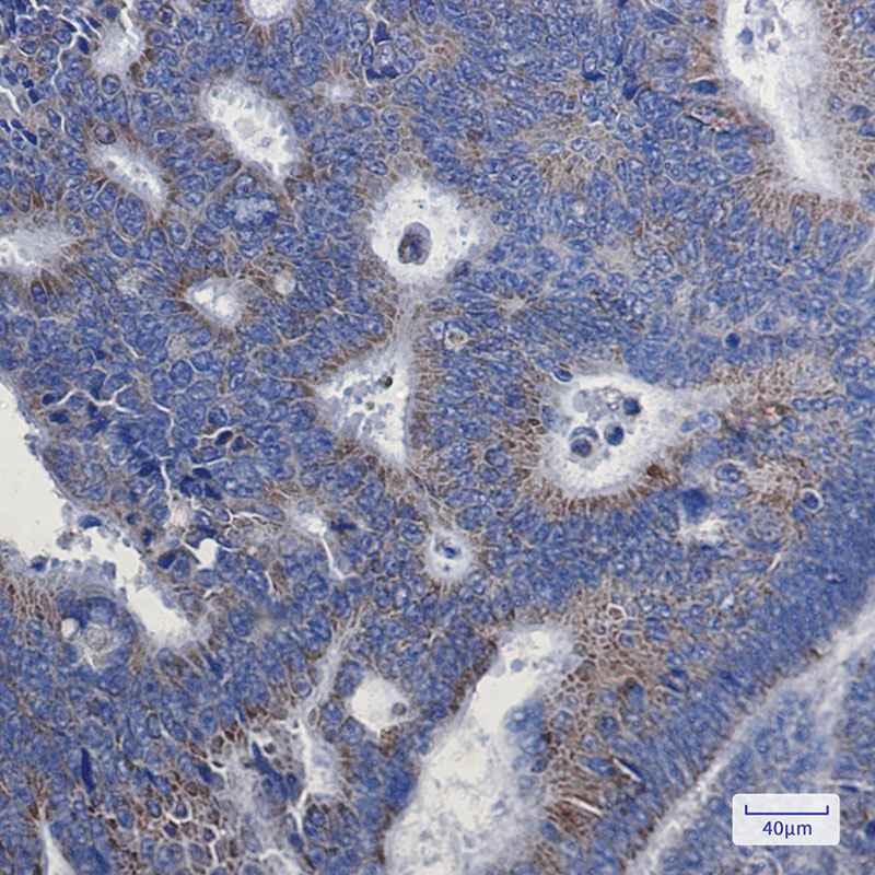 2 - [KD]NDUFA1 Rabbit mAb AP75776