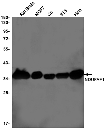 1 - NDUFAF1 Rabbit mAb AP75777