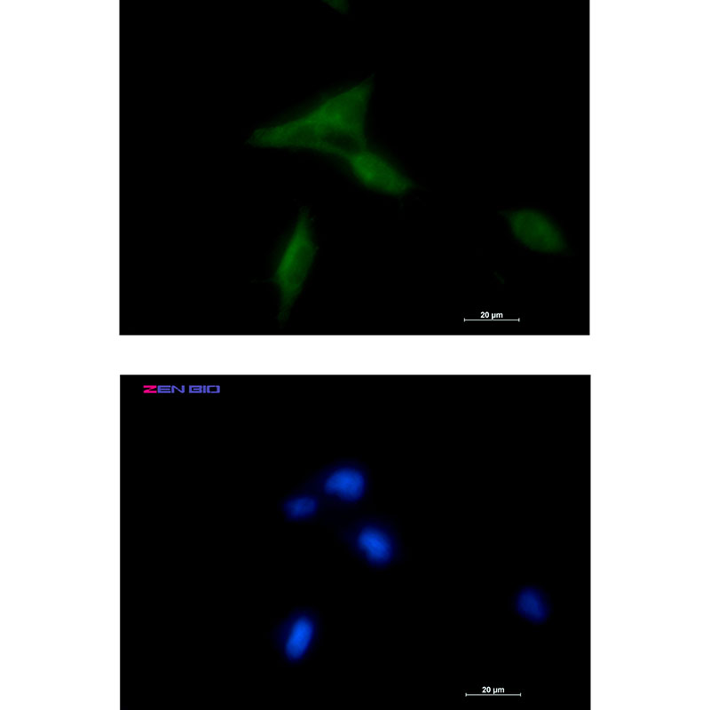 1 - NDUFAF1 Rabbit mAb AP75778