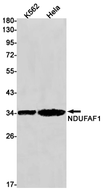 2 - NDUFAF1 Rabbit mAb AP75778