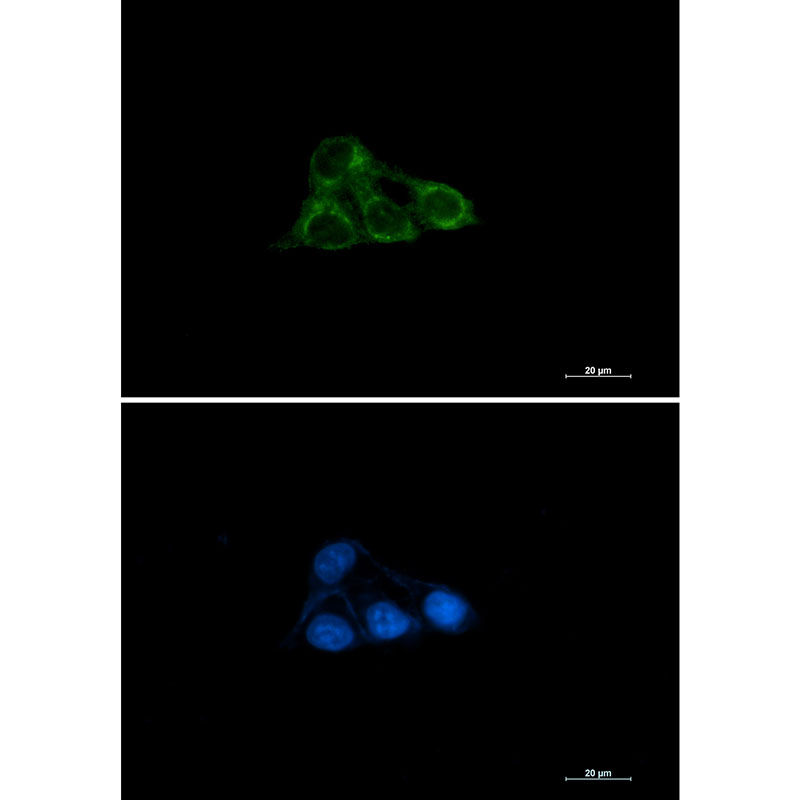 1 - NDUFAF4 Rabbit mAb AP75779