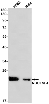8 - NDUFAF4 Rabbit mAb AP75779