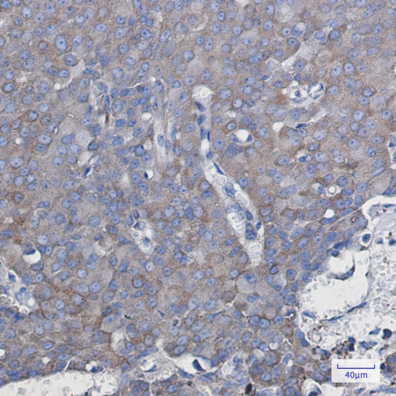 2 - NDUFAF5 Rabbit mAb AP75780