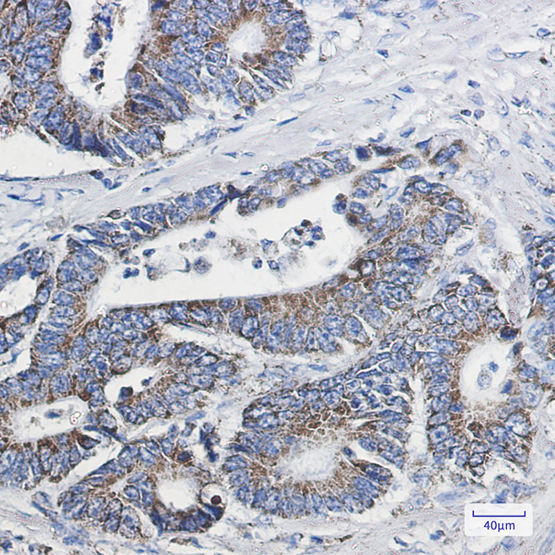 2 - NDUFB10 Rabbit mAb AP75781