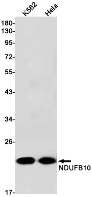 1 - NDUFB10 Rabbit mAb AP75781