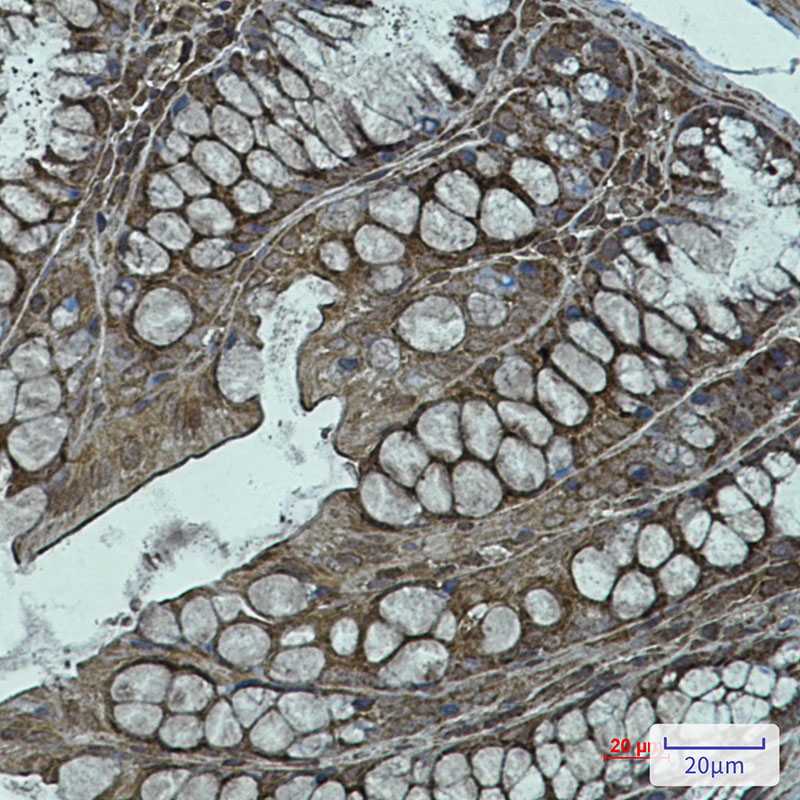 1 - NDUFB11 Rabbit mAb AP75782