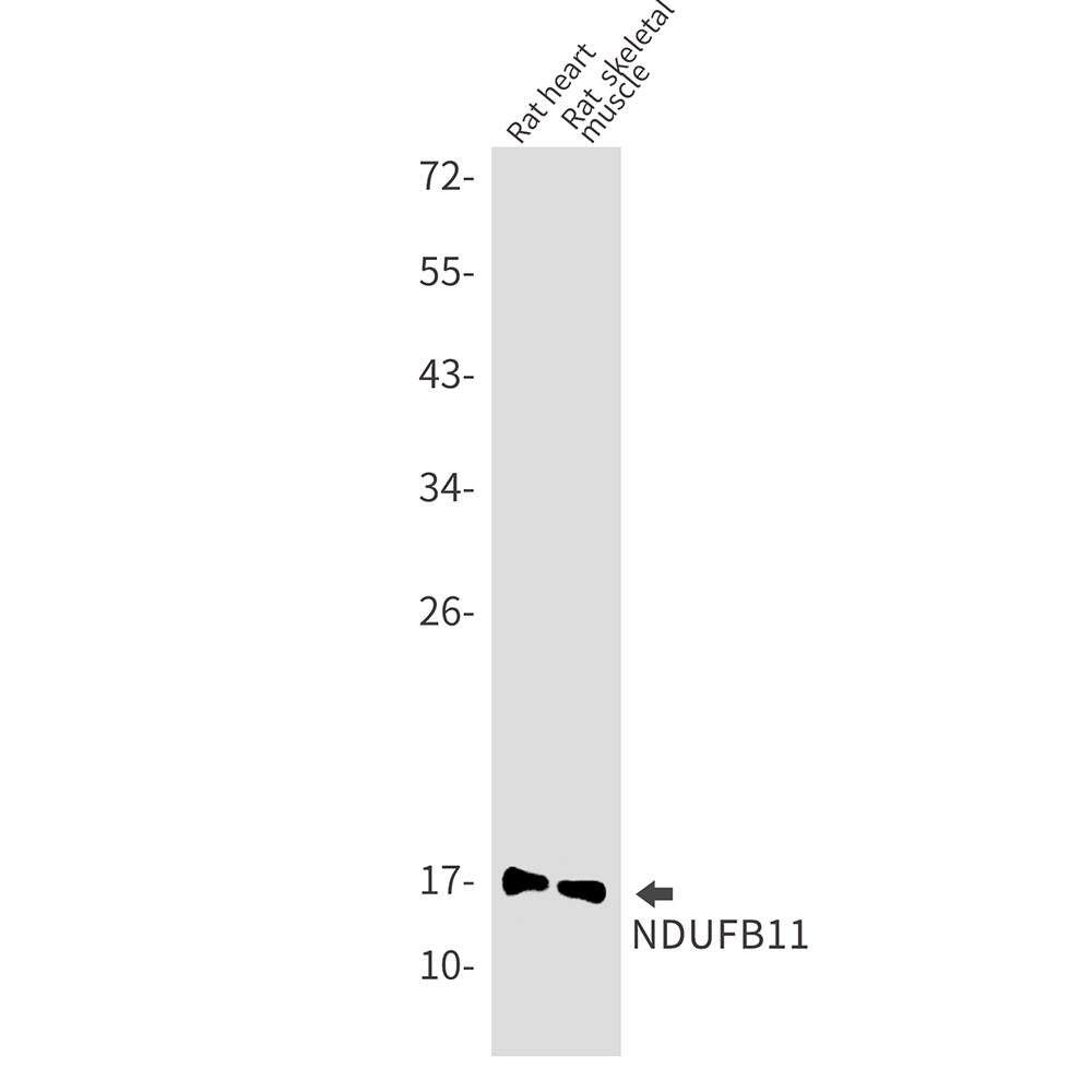 2 - NDUFB11 Rabbit mAb AP75782
