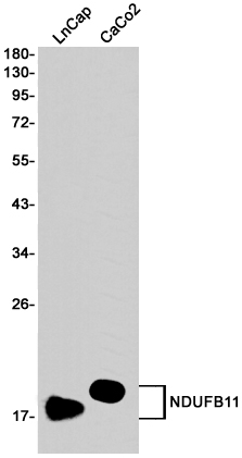 4 - NDUFB11 Rabbit mAb AP75782