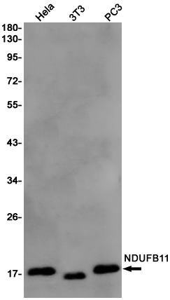 0 - NDUFB11 Rabbit mAb AP75782
