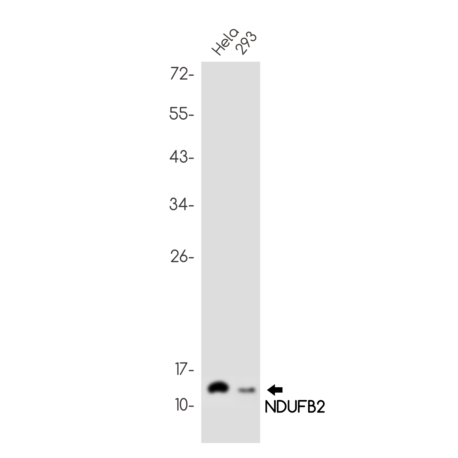 1 - NDUFB2 Rabbit mAb AP75783