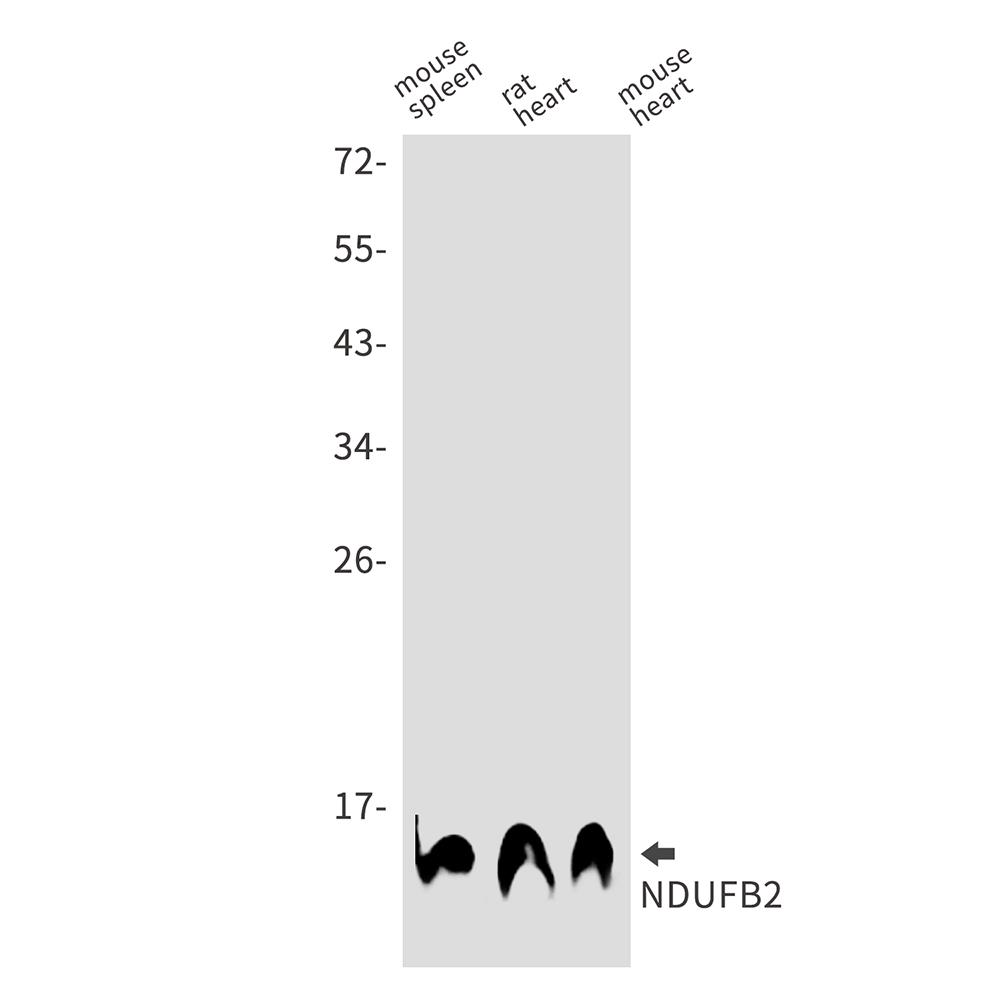 2 - NDUFB2 Rabbit mAb AP75783