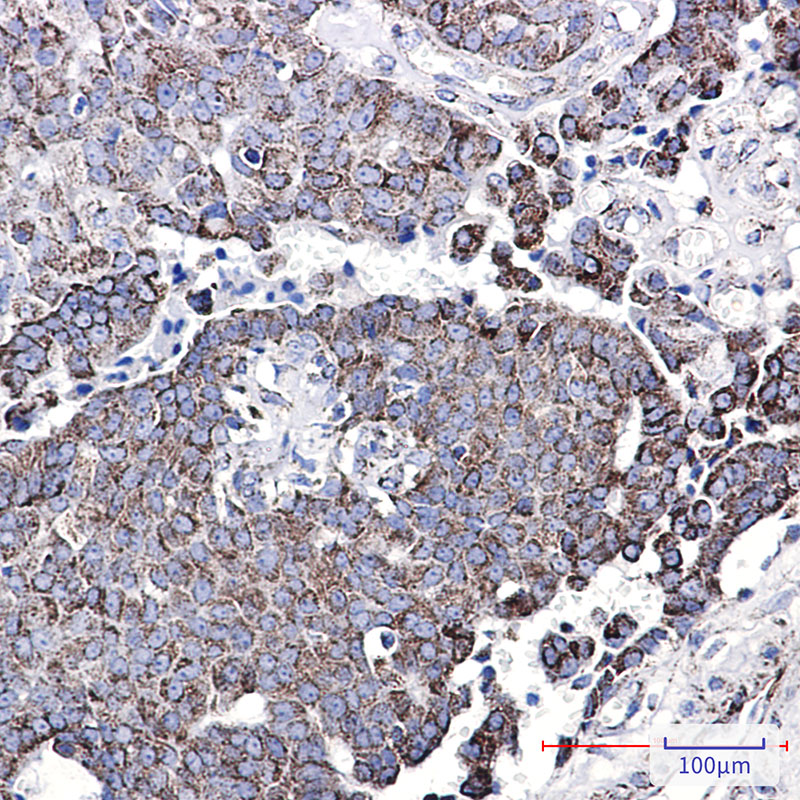 2 - NDUFC2 Rabbit mAb AP75786