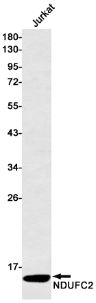 1 - NDUFC2 Rabbit mAb AP75786