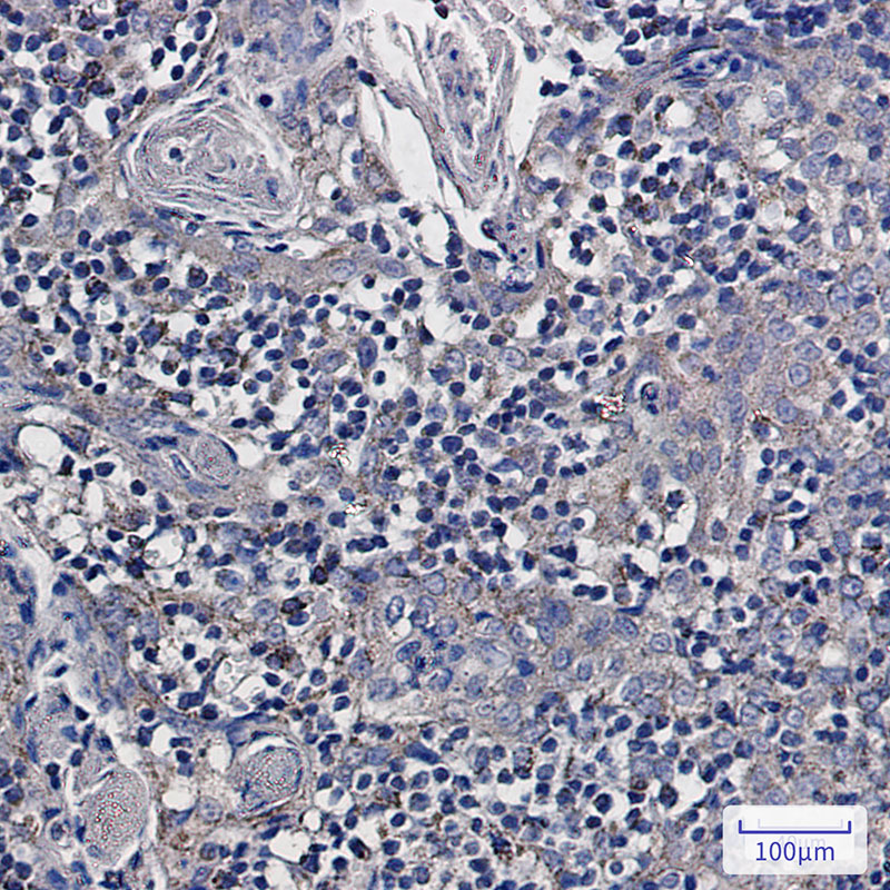 3 - NDUFS6 Rabbit mAb AP75789