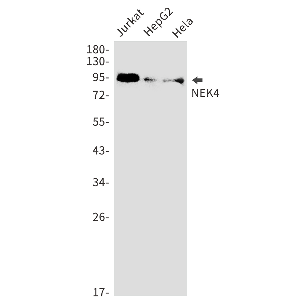 1 - NEK4 Rabbit mAb AP75792