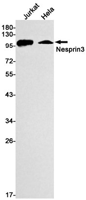 1 - Nesprin3 Rabbit mAb AP75797
