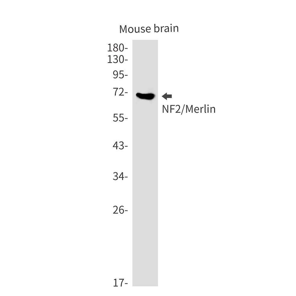 1 - NF2/Merlin Rabbit mAb AP75803