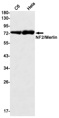 0 - NF2/Merlin Rabbit mAb AP75803