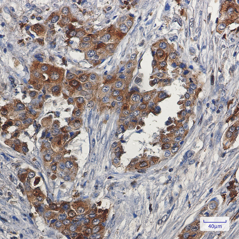 2 - [KD]Niemann Pick C2 Rabbit mAb AP75810