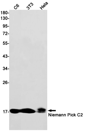1 - [KD]Niemann Pick C2 Rabbit mAb AP75810