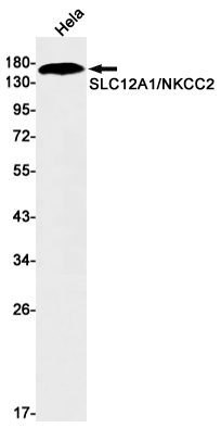 1 - SLC12A1/NKCC2 Rabbit mAb AP75812