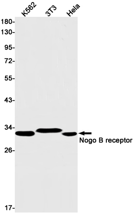 1 - Nogo B Receptor Rabbit mAb AP75815