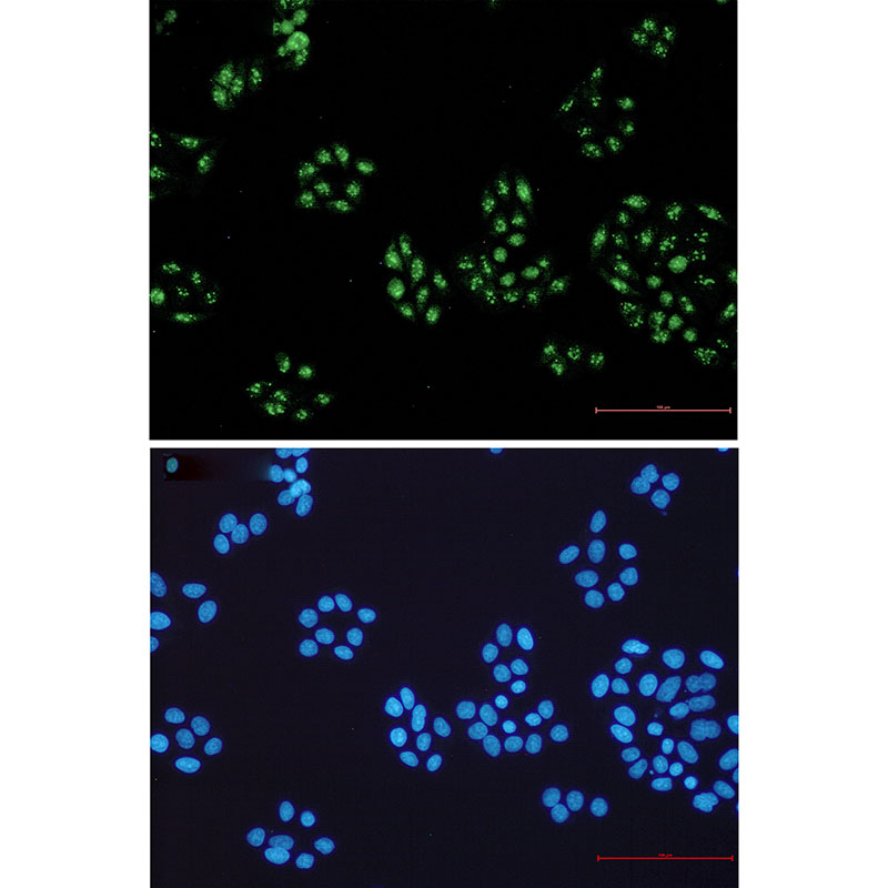 8 - NOLC1 Rabbit mAb AP75816