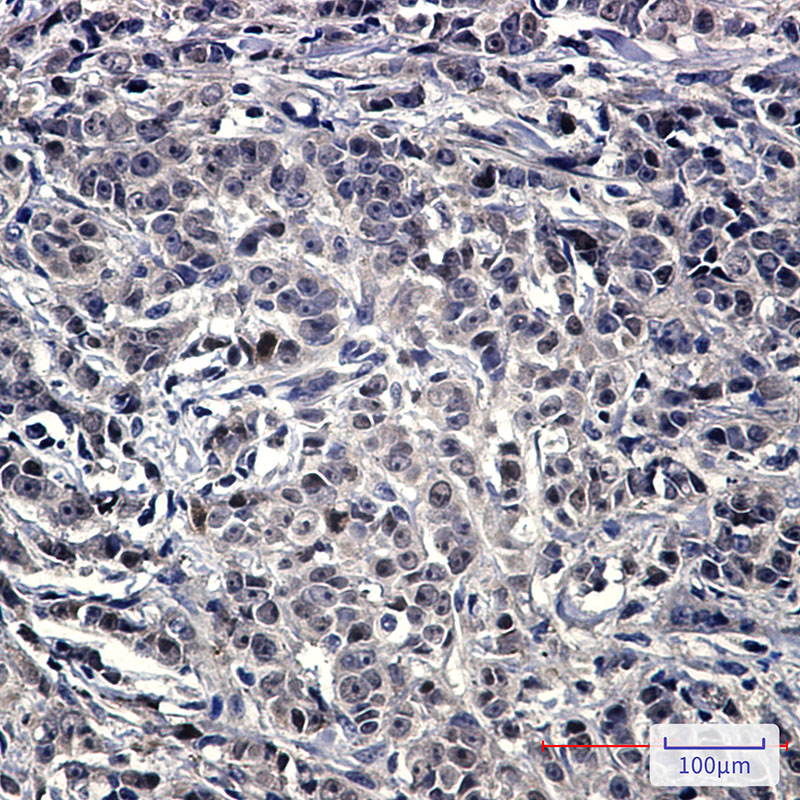 2 - NOLC1 Rabbit mAb AP75816