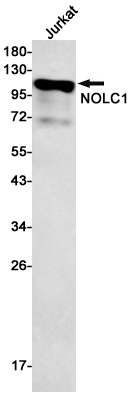 1 - NOLC1 Rabbit mAb AP75816