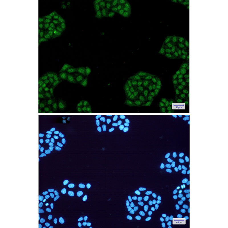 2 - NR1D1 Rabbit mAb AP75820