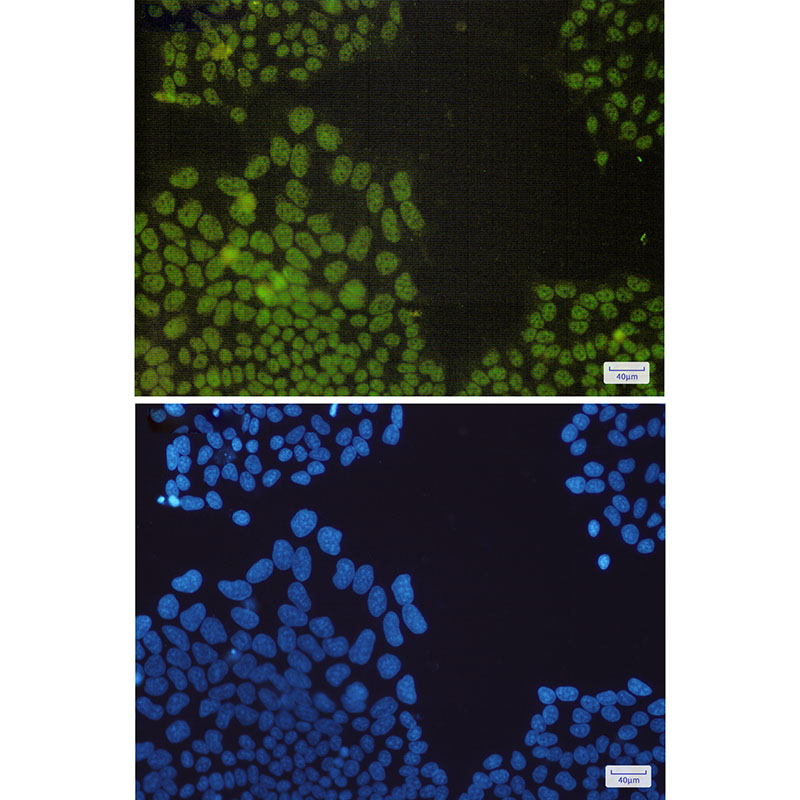 2 - NRF1 Rabbit mAb AP75821