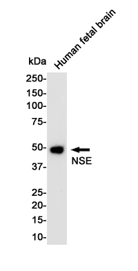 1 - NSE Rabbit mAb AP75823