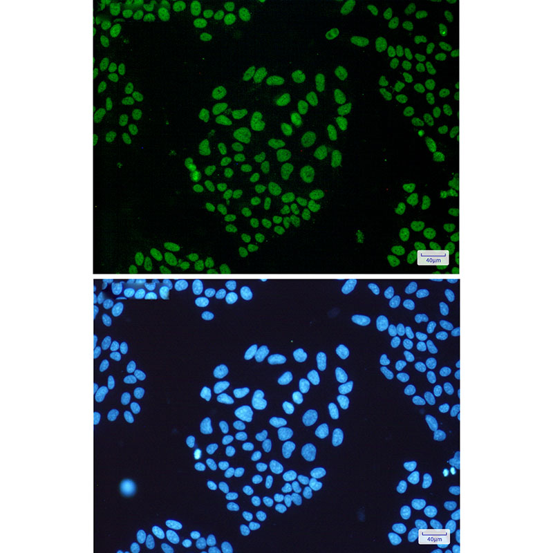 2 - THOC1 Rabbit mAb AP75825