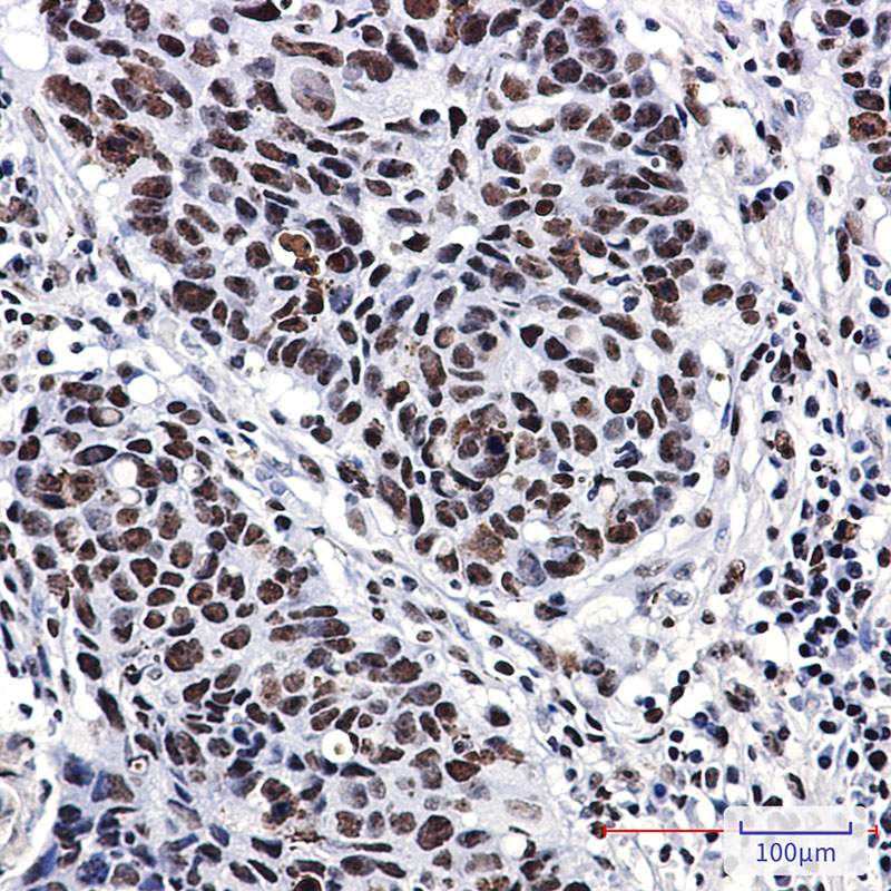 2 - Nucleophosmin Rabbit mAb AP75827