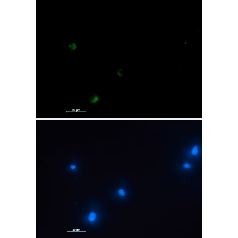 1 - NUDT19 Rabbit mAb AP75830
