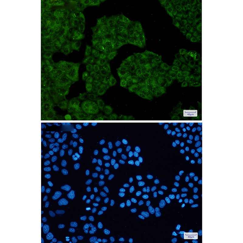 2 - NUDT9 Rabbit mAb AP75831