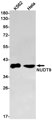 1 - NUDT9 Rabbit mAb AP75831