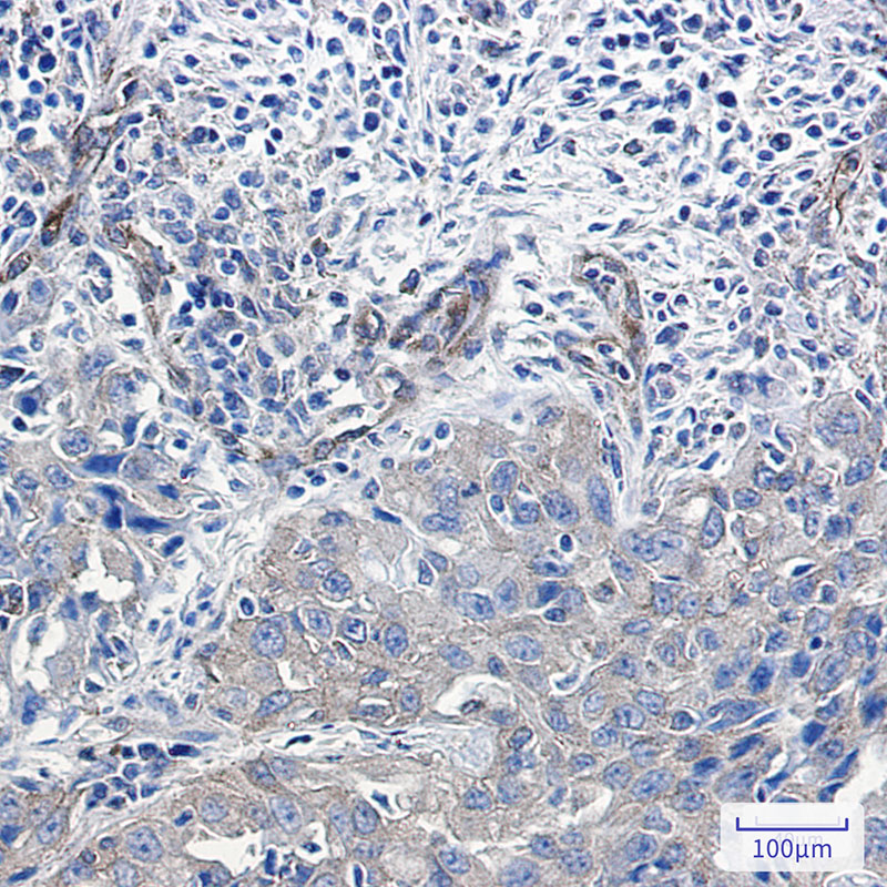 4 - [KO]NUMB Rabbit mAb AP75833