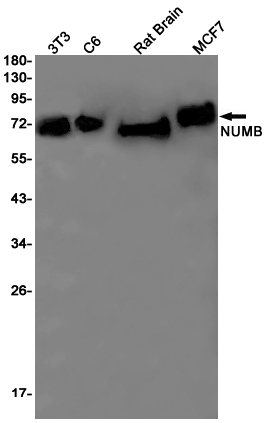 2 - [KO]NUMB Rabbit mAb AP75833